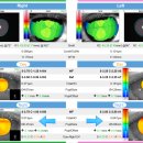 새롬안경원 이미지
