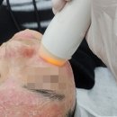 장유누가병원 | [최혜영뷰티 장유율하점] 피부 뒤집어졌을 때, 제일 먼저 해야 할 6가지