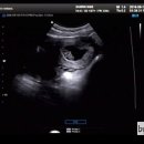 자모산부인과의원 이미지