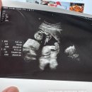 서울봄산부인과의원 이미지