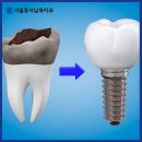 불로치과의원 이미지