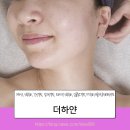 케어로 | 압구정경락 더하얀 신부관리케어로 중안부축소 후기