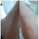 신진조선소 | 군산발각질, 단순 각질이 아닌 ‘피부의 경고’ — 소브라운지에서 근본 관리로 해결하다