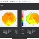 라운드안경(렌즈아이) 이미지