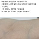 백신 접종자의 피부에 나타나는 '육각형 벌집 구조'는 '신체 인터넷'(IoB)의 발현이다! 이미지