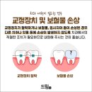 자기치아살리기365일야간드림플란트치과병원 이미지