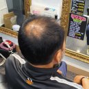 김호증모가발by헤어리서치