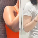 롯데칠성음료(주)영등포지점 | 영등포 무한람스 10주차 후기, 팔뚝 지흡 회복기간 솔직 정리