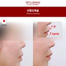 리터닝성형외과의원