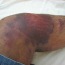 산들부부한의원 이미지