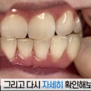 워터픽 사용과 별개로 치실을 써야하는 이유와 순서.jpg 이미지