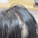 현스헤어 - 의왕시 | “뒷통수 갈라짐 고민 해결! 오남리 현스헤어 링거펌 & 볼륨펌 후기”