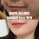 올리뷰티 - 강서구 | [올리뷰티/강남] 입술 필러 1cc 후기, 자연스럽게 볼륨 살아난 레스틸렌 입술필러 후기