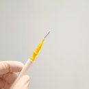 밝은결치과의원 | 인접면 충치 치료, 육안으로 파악이 힘든 어금니 사이 충치에 대해 (밝은결치과의원 작성)