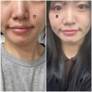 인천 굴포천역 쥬브아셀 후기 가져옴.
