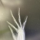 맘스터치 월내점 이미지