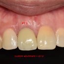 푸른치과기공소 이미지