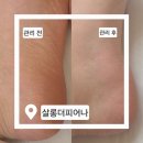 구미페이스왁싱 잘하는 곳 찾았어요! 살롱더피어나 패디플래닝 후기 🫧💅