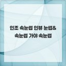 인뷰