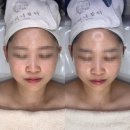 글리나뷰티 이미지