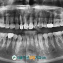 진천치과기공소 이미지
