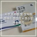 젠스토어 | 피부 트러블 및 상처에 젠메드 젠스팟 젠스왑 사용 후기