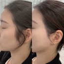 리뷰티왁싱 에스테틱