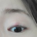 자연과 콩 | [눈꺼풀 콩다래끼 후기] 콩다래끼 자연치료해보려고 난리쳐본 썰 | 다래끼 원인 | 콩다래끼 온찜질