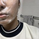 바른공방 | 정화공방 유황비누, 모낭충비누 추천 후기!