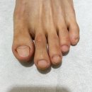 닥터페디매료네일