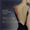 아미스킨 이미지