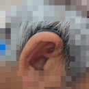 비인건강노인건강센터(1층목욕탕) | 밀양시 의료기기 밀양보청기 소음성 난청 으로 산재 판정 받으신 고객님, 오픈형 보청기 착용 후기입니다.