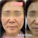 신통한피부관리