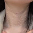 고운성형외과의원 | 목주름필러, 배우 박준금님의 관리