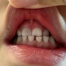 고덕키즈앤탑치과의원 이미지