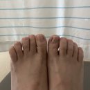 진와이어센틱 | 내돈내산 문제성 굽은 발톱 교정 5차까지 받아본 솔직 후기 (비용, 셀프 교정 금지인 이유)