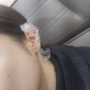 바늘요정 | 압구정역피부과 귀필러ㅣ요정귀필러 후기ㅣ 통증ㅣ가격ㅣ비용
