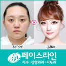윤곽