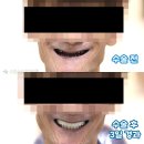 이승훈치과의원 네이버블로그