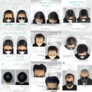 모발란스 네이버블로그