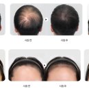 헤어온의원 이미지