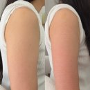 어본에스테 피부관리 포항점 | 포항웨딩관리 어본에스테 팔뚝 관리 1회만으로 효과 대박
