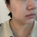 디지털스킨 | 구로디지털피부관리 숨스킨 신부관리 솔직 후기 | 구로에스테틱 윤곽관리 맛집 추천