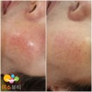 명품지우개 뷰티 네이버블로그
