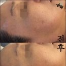 려원스킨케어