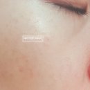 와이앤피 이미지