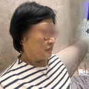 안희 | 강남역 피부과 온다리프팅 : 어버이날 엄마 리프팅 추천 후기(비포&애프터)