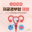 암 재활 이미지