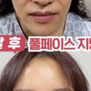 스카이쁘아뜨의원 이미지