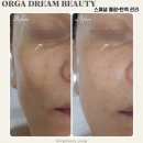 더율메디칼 | [익산 피부관리 후기] 피부맛집은 더:율 에스테틱